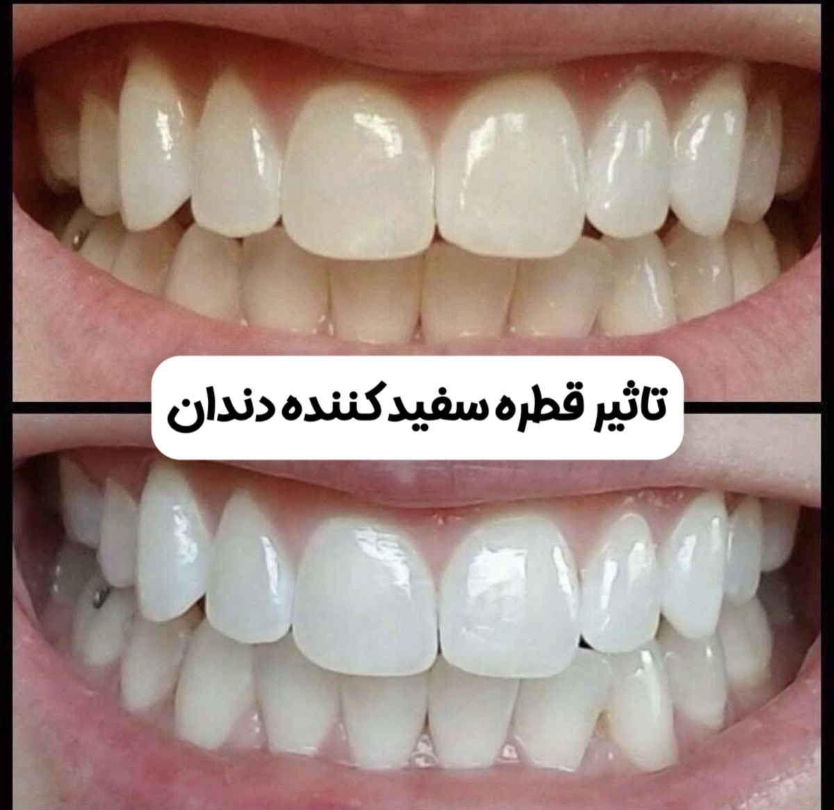 قطره سفید کننده دندان لانبنا